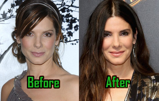 Sandra Bullock Plastic Surgery Changed Her Nose Before After