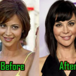 Catherine Bell Surgery Before After