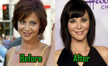 Catherine Bell Surgery Before After