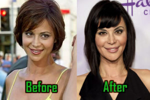 Catherine Bell Surgery Before After