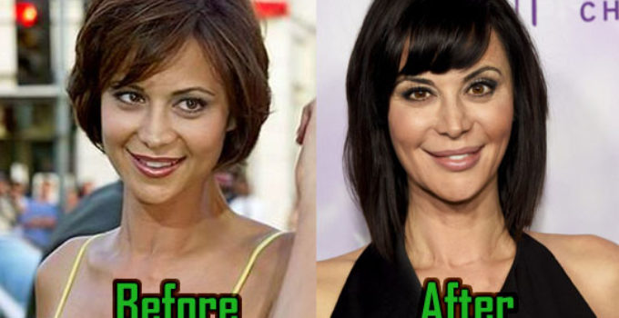Catherine Bell Surgery Before After.