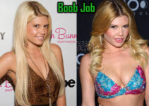 Chanel West Coast Boob Job, Plastic Surgery Before After