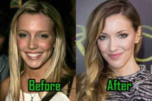 Katie Cassidy Plastic Surgery Is Too Obvious To Deny