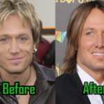 Keith Urban Surgery