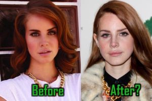 Lana Del Rey Plastic Surgery Merely for Image Shifting?
