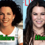 Lauren Graham Surgery, Botox