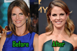 Natalie Morales Plastic Surgery: Before & After Facelift Botox
