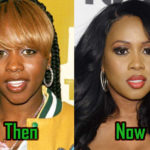 Remy Ma Cosmetic Surgery