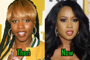 Remy Ma Cosmetic Surgery