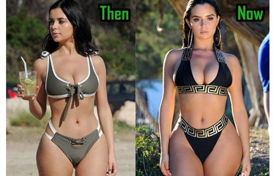 Demi Mawby Surgery, Butt, Before After