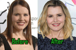 Geena Davis Plastic Surgery Creates Natural, Ageless Face, Before & After