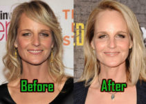 Helen Hunt Plastic Surgery: Facelift, Fillers, Before And After Photos!
