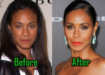Jada Pinkett Smith: Plastic Surgery for Eternal Youth? Before-After!
