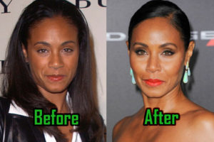 Jada Pinkett Smith: Plastic Surgery for Eternal Youth? Before-After!