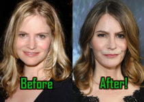 Jennifer Jason Leigh: Plastic Surgery Modifies Her Face. Before-After!