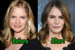 Jennifer Jason Leigh: Plastic Surgery Modifies Her Face. Before-After!