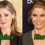 Julie Bowen Surgery, Before After Photo