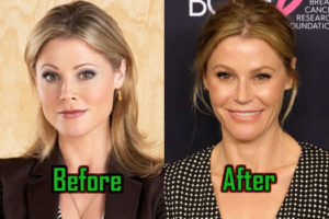 Julie Bowen Plastic Surgery: Facelift, Botox, Before After!