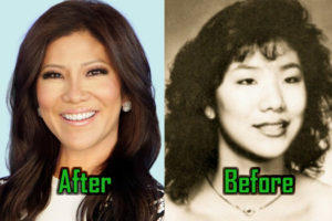 Julie Chen: Plastic Surgery to Fight Racism! Before-After Photos!