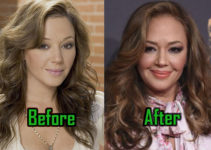 Leah Remini Plastic Surgery: Facelift, Lips Surgery? Before-After!