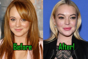 Lindsay Lohan Plastic Surgery Dramatically Changes Her Look!