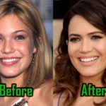 Mandy Moore Plastic Surgery