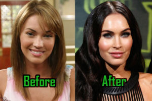 Megan Fox: Plastic Surgery Behind Her Drastic Transformation, Before-After!