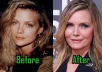 Michelle Pfeiffer Plastic Surgery