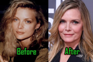 Michelle Pfeiffer Plastic Surgery Creates Age-Defying Face! Before-After