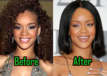 Rihanna Plastic Surgery: Perfect Nose Job? Before & After!