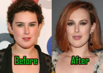 Rumer Willis Plastic Surgery Reduced Her Jaw? Before-After!