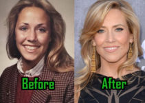 Sheryl Crow Plastic Surgery: A Natural-Looking Facelift, Before & After