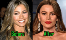 Sofia Vergara Plastic Surgery