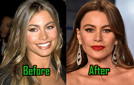 Sofia Vergara Plastic Surgery Creates Perfect Boobs, Before & After! -