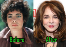 Stockard Channing Plastic Surgery Drastically Changed Her Face, Before-After!