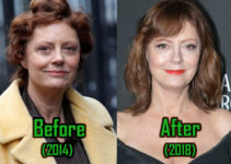 Susan Sarandon Plastic Surgery: Facelift, Boobs Job, Before & After!