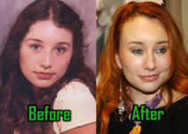 Tori Amos Plastic Surgery: Awful Before-After Photo!