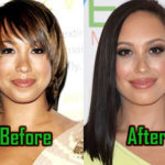 Cheryl Burke Plastic Surgery