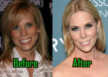 Cheryl Hines Plastic Surgery: Facelift, Boob Job, Before After!