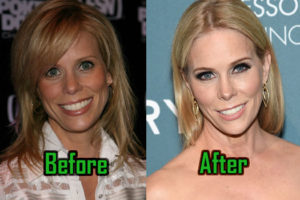 Cheryl Hines Plastic Surgery: Facelift, Boob Job, Before After!