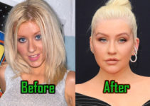 Christina Aguilera Plastic Surgery Photo