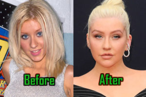 Christina Aguilera Plastic Surgery Photo