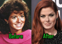Debra Messing Plastic Surgery: Nose Job and Eye Lift? Before After!