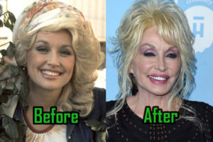 Dolly Parton: Can’t Live Without Plastic Surgery!