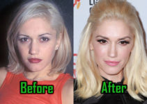 Gwen Stefani Plastic Surgery: Facelift, Nose Job, Before-After!