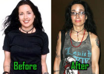 Janeane Garofalo Plastic Surgery: Breast Reduction, Nose Job, Before After!