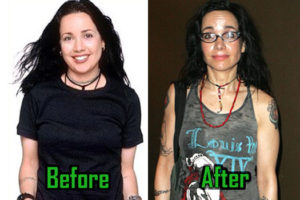 Janeane Garofalo Plastic Surgery: Breast Reduction, Nose Job, Before After!
