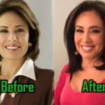 Jeanine Pirro Plastic Surgery
