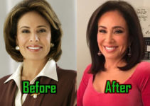 Jeanine Pirro Plastic Surgery: Facelift, Boob Job, Before After!