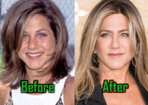 Jennifer Aniston: Plastic Surgery Alters Her Nose! Before-After Photos!